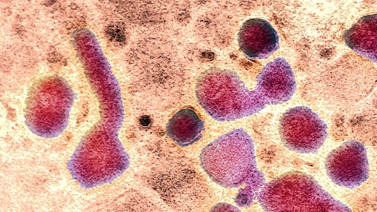 Une seule mutation du virus H5N1 facilite l&rsquo;infection humaine (étude)