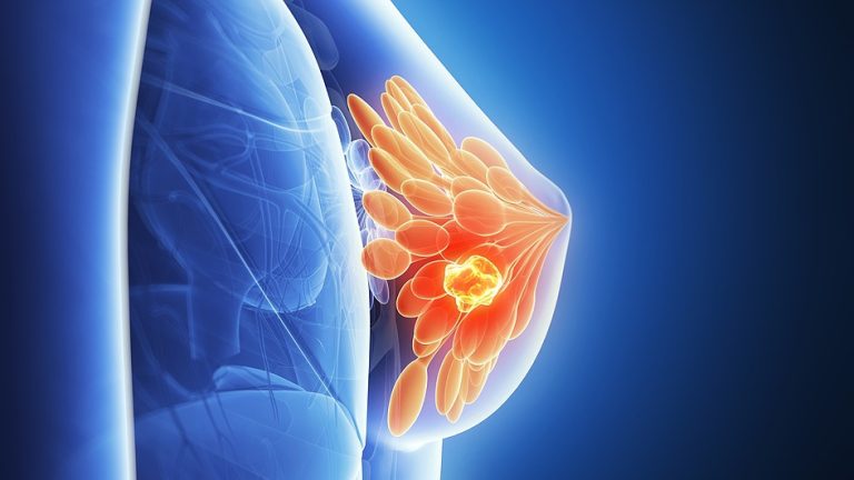 Les chercheurs découvrent la dormance du cancer, allusion aux nouveaux traitements