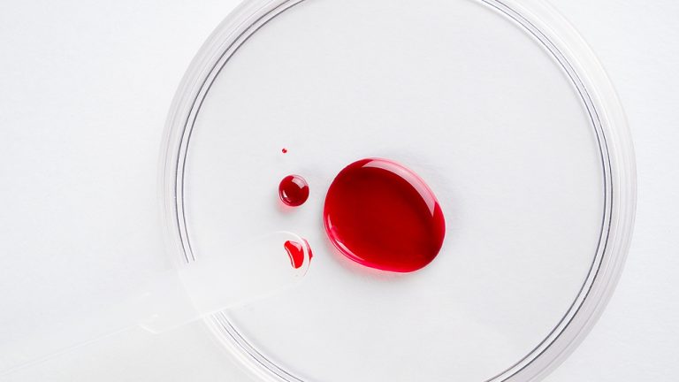 «  Forever Chemicals  » détecté dans du sang de plus de 85% des Australiens