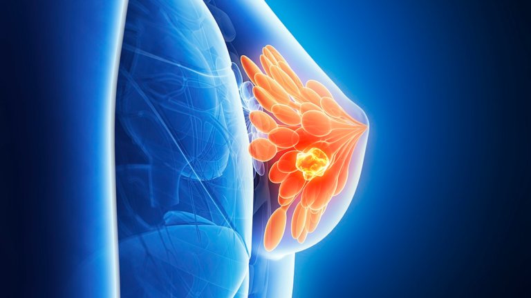 Une étude australienne révèle que l&rsquo;allaitement aide à prévenir le cancer du sein