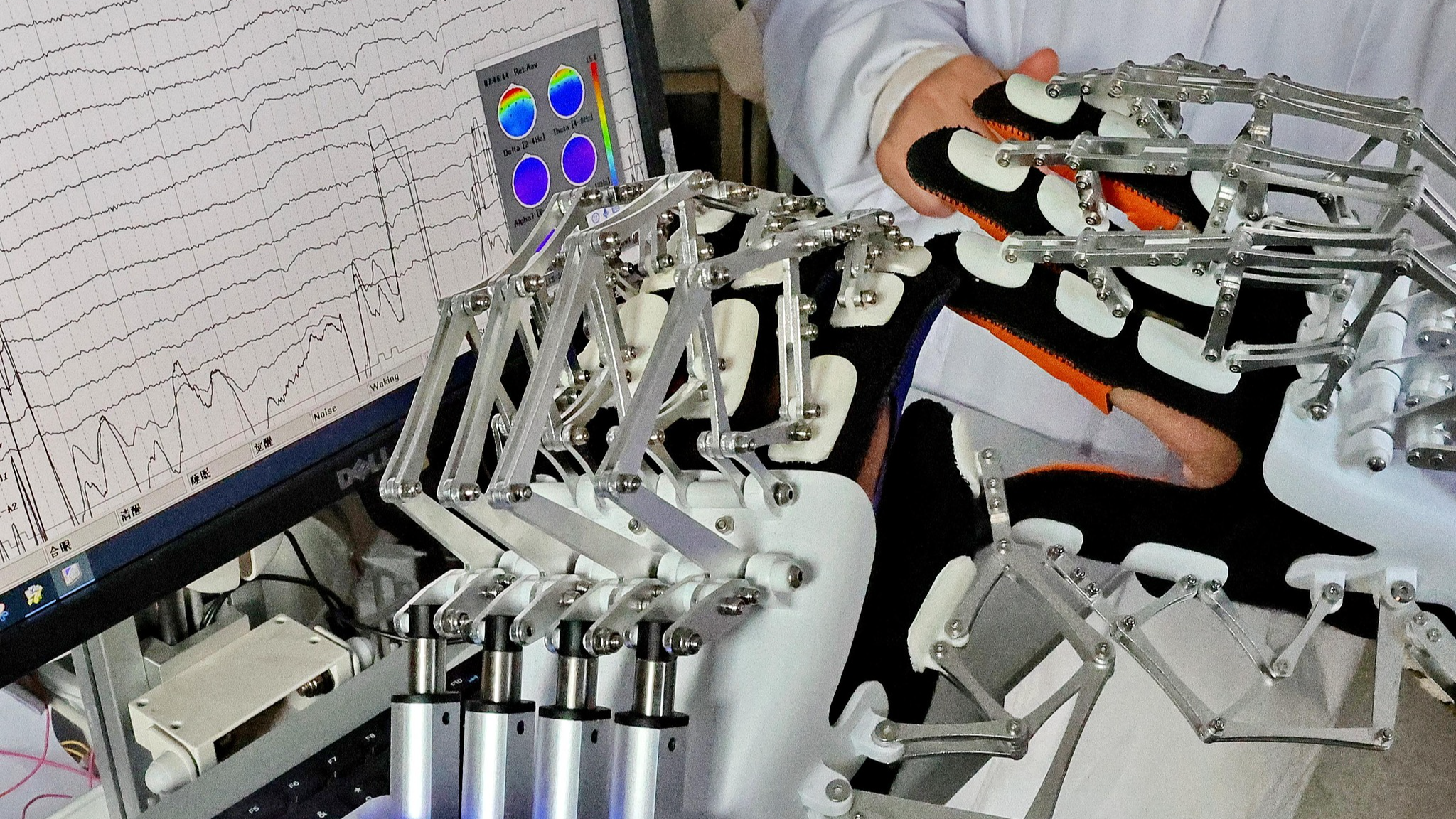 Des chercheurs de l'Université de Yanshan et du personnel médical testent un système manuel robotique contrôlé par le cerveau à Qinhuangdao, province du Hebei, le 23 décembre 2025. /VCG