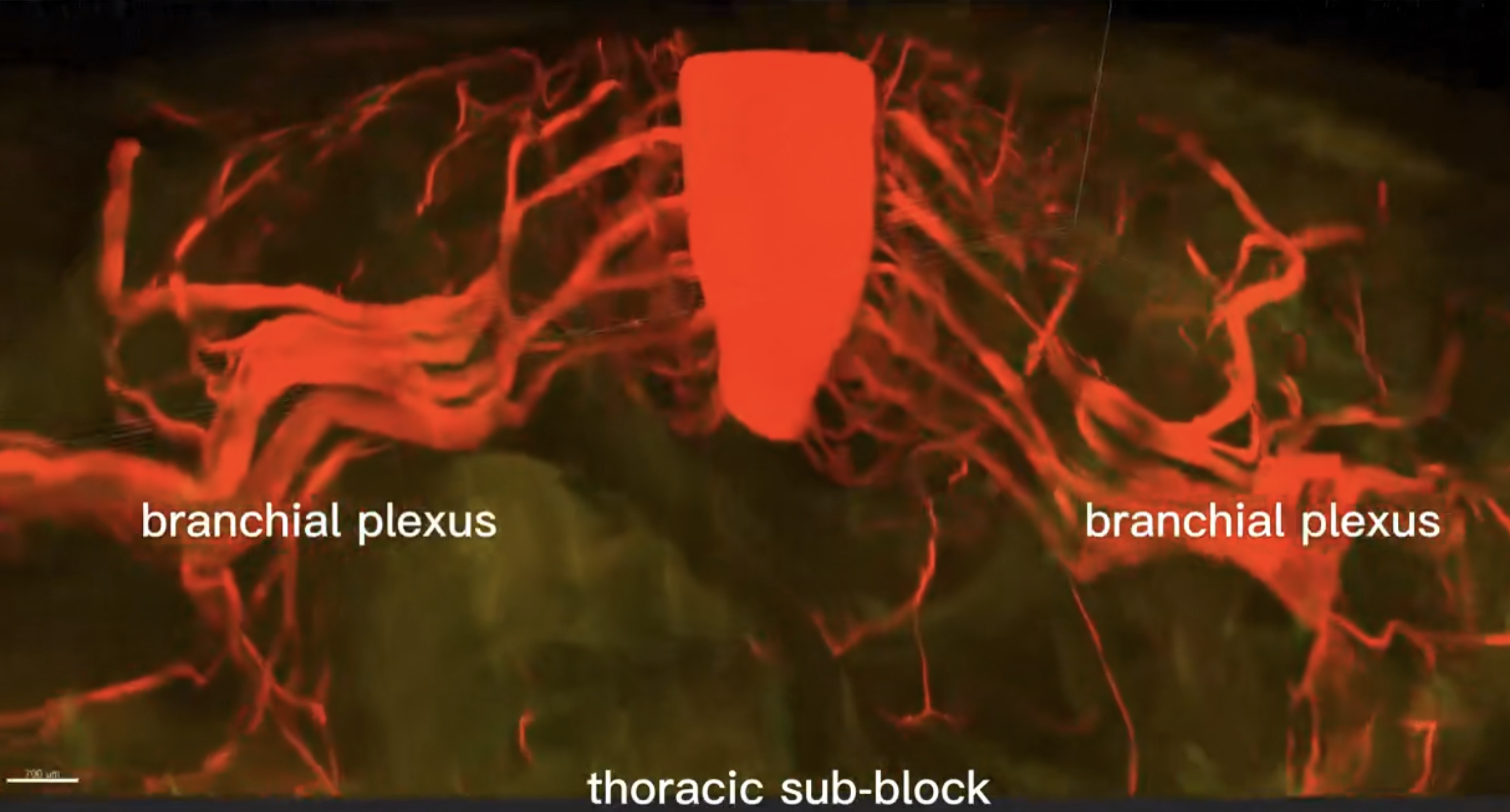 Reconstruction neuronale du corps entier chez une souris par la méthode TESOS. /CIBR