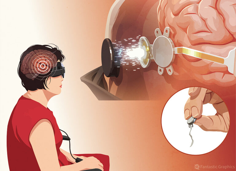 Qu’est-ce qu’une interface cerveau-ordinateur et comment fonctionne-t-elle ?