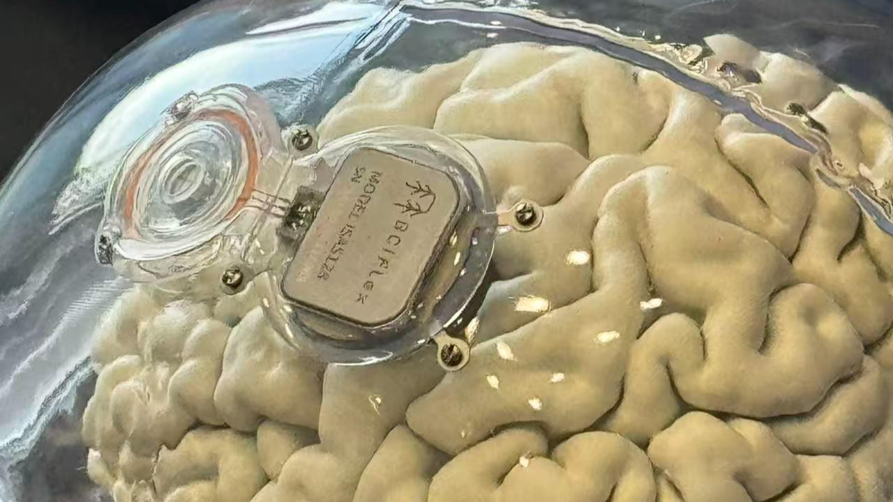 Un modèle illustrant le placement d'une interface cerveau-ordinateur dans le cerveau. /CMG